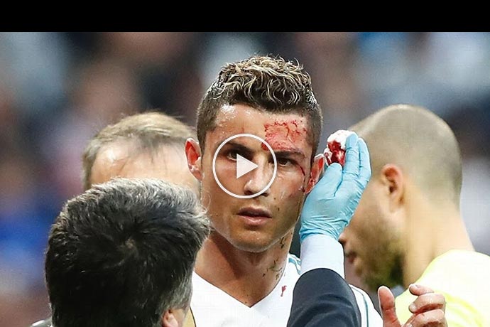 Video: 5 Goals Cristiano Ronaldo Scored with Worst Health Conditions Pain/Injury